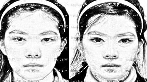 杭州隆鼻哪家医院好?揭秘杭州隆鼻医生排名前五榜单|附介绍