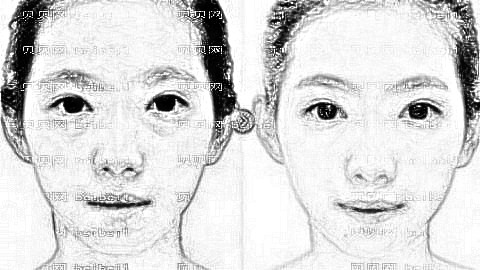 杭州去眼袋哪家医院好?杭州去眼袋医生排名名单&附介绍
