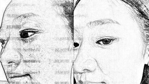 杭州祛斑哪家医院好?杭州激光祛斑多少钱?附祛斑介绍
