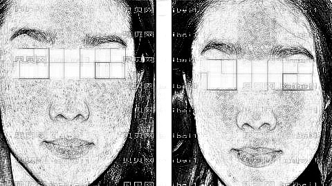 合肥祛斑哪家医院好?合肥激光祛斑多少钱?附祛斑介绍
