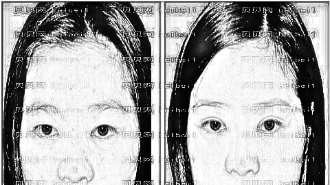 嘉兴双眼皮医生测评前十专家名单,附双眼皮价格一览表