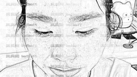 温州一院激光祛斑好不好?祛斑手术介绍及收费