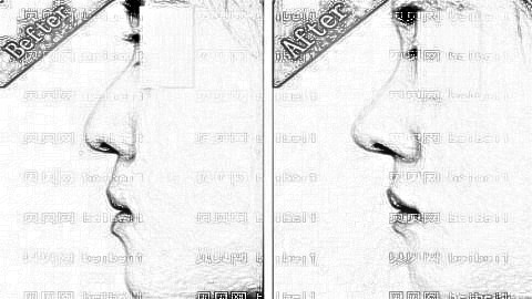 惠州隆鼻哪家医院好?揭秘惠州隆鼻医生排名前五榜单|附介绍