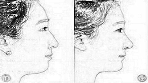 常州隆鼻哪家医院好?常州隆鼻哪个医生技术好?附介绍