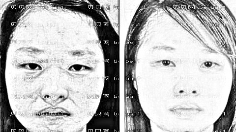 北京祛斑哪家医院好?北京激光祛斑多少钱?附祛斑介绍