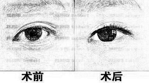 拉萨去眼袋哪家医院好?拉萨去眼袋医生排名名单&附介绍