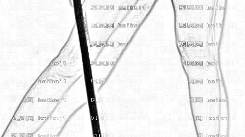 北京悦然李京霖吸脂怎么样?北京悦然李京霖吸脂介绍及