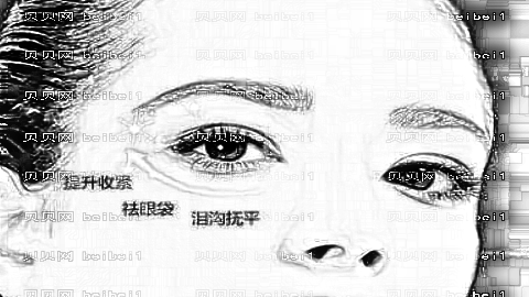 郜玉龙医生去眼袋怎么样?郜玉龙医生超声波去眼袋介绍,眼袋消失心情好!