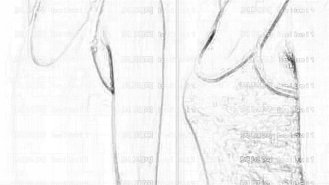 无锡丰胸哪个医生技术好?公布无锡隆胸医生前五榜单,附