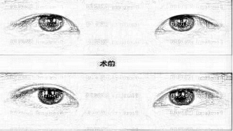 焦作做双眼皮哪家医院好？焦作双眼皮医生排名名单&附介绍