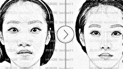 周口隆鼻哪家医院好?公布周口隆鼻医生排名前五榜单|附介绍