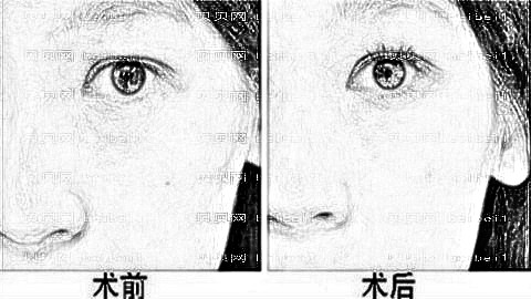 珠海去眼袋哪家医院好?珠海去眼袋医生排名名单&附介绍