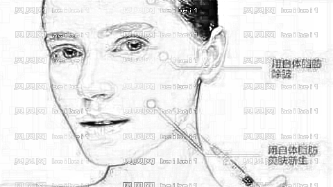杭州做脂肪填充好的医生有哪些?杭州脂肪填充医生介绍名单