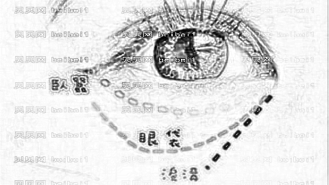 菏泽中医院做去眼袋怎么样?菏泽哪家医院去眼袋介绍及