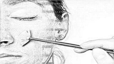 南阳祛斑哪家医院好?南阳激光祛斑多少钱?附祛斑介绍