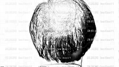 南京植发哪家医院好?多少钱?附南京植发医生排名名单
