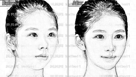 长沙雅美袁妍妍医生怎么样?擅长哪些项目?玻尿酸丰下巴多少钱?