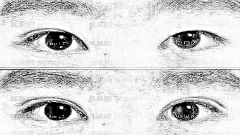 协雅明经发双眼皮做的怎么样？明经发全切双眼皮介绍,果自然！
