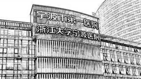 宁波一院秒皮激光怎么样?秒皮激光手术介绍表?