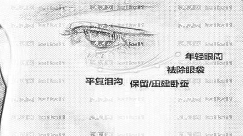 青岛伊美尔医院去眼袋怎么样?伊美尔眼袋抽脂介绍,医生较为好!