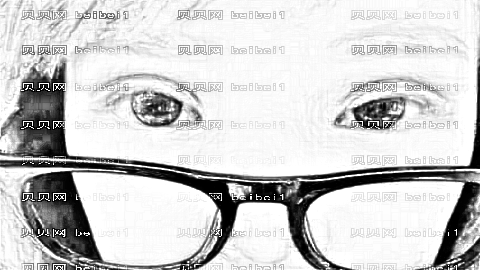 上海九院林明做双眼皮怎么样?上海九院林明做的双眼皮介绍,恢复很好!