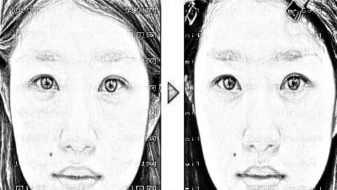 东莞美立方李志刚口碑好不好?李志刚做眼袋果好吗?附介绍