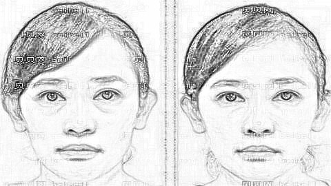 福州美莱华美李丹做眼袋怎么样?李丹去眼袋收费高吗?附介绍