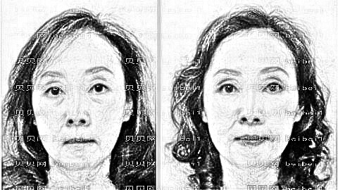 福州名韩温名赟去眼袋手术技术怎么样?温名赟做眼袋价格贵吗?