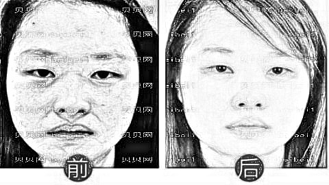 漳州祛斑哪家医院好？漳州激光祛斑多少钱？附祛斑介绍