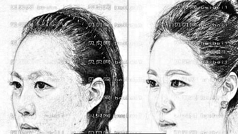 长沙植发哪家医院好?多少钱?附长沙植发医生排名名单