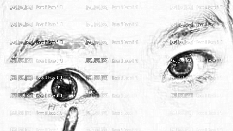 温医一院开眼角手术怎么样?温医一院开眼角手术介绍,术后很好看!