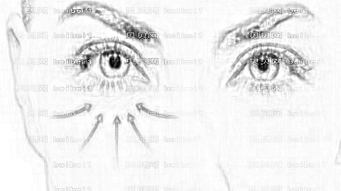 深圳健丽医疗美容去眼袋怎么样?健丽医美去眼袋正规吗?附介绍