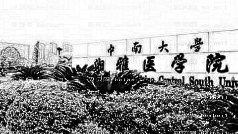 湘雅做眼睛手术怎么样?,湘雅做眼睛手术介绍及