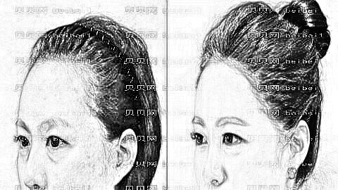 郑州植发哪家医院好?多少钱?附郑州植发医生排名名单
