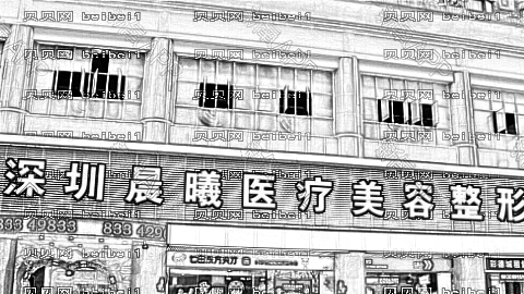 深圳晨曦做眼睛怎么样?深圳晨曦做眼睛介绍,很期待!