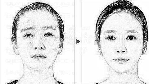 揭秘天津脂肪填充排名前五医生名单|附医生介绍+介绍分享