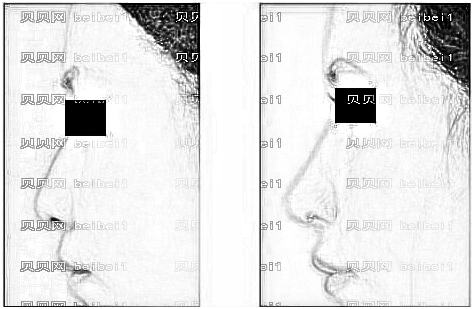 重庆美伽整形医院怎么样?医生团队+整形价格