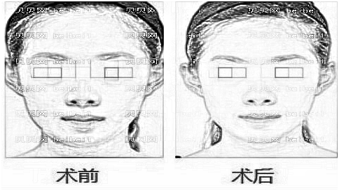 重庆光博士整形医院怎么样?医生团队+整形价格