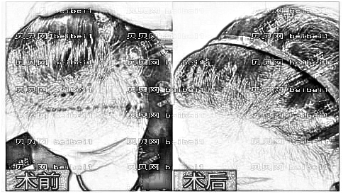 瑞安瑞丽整形医院怎么样?医生团队+整形价格