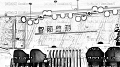 智颜整形医院去眼袋怎么样?智颜医疗美容眼袋切除介绍,没有眼袋心情好!