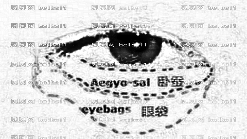 中研医院去眼袋怎么样?中研医院去眼袋介绍,眼袋不见了!
