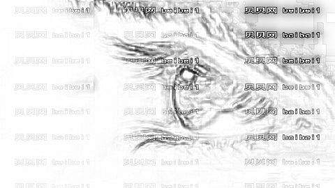 钟宗明做眼睛怎么样?,钟宗明做眼睛介绍及