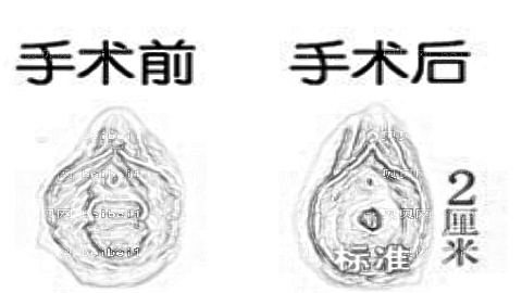 成都九龙私密整形怎么样?医生团队+整形价格