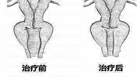 成都私密整形医院怎么样?医生团队+整形价格