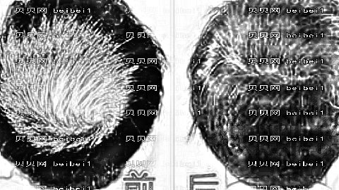 东莞科医能整形技术怎么样?,植发价格一览表!医生介绍