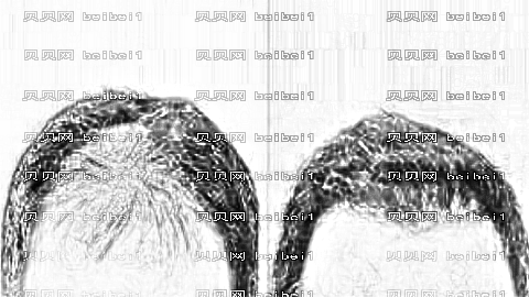 广州倍生植发技术怎么样？较新植发价格一览表！医生排名名单