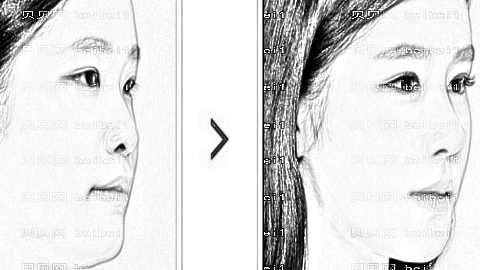 哈尔滨华美整形医院怎么样?医生团队+整形价格