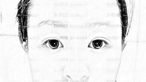 自体隆鼻需要多久?自体隆鼻要打几天消炎针?