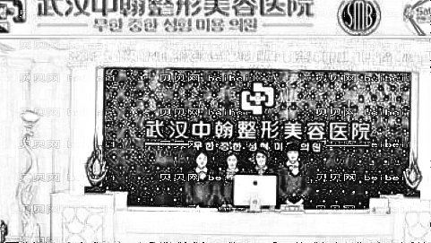 中翰整形去眼袋怎么样?中翰整形激光祛眼袋介绍,医院很不错!