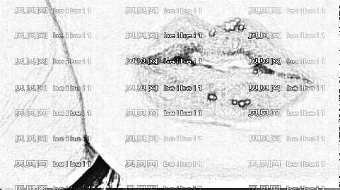 上海新浦口腔医院怎么样?医生介绍名单